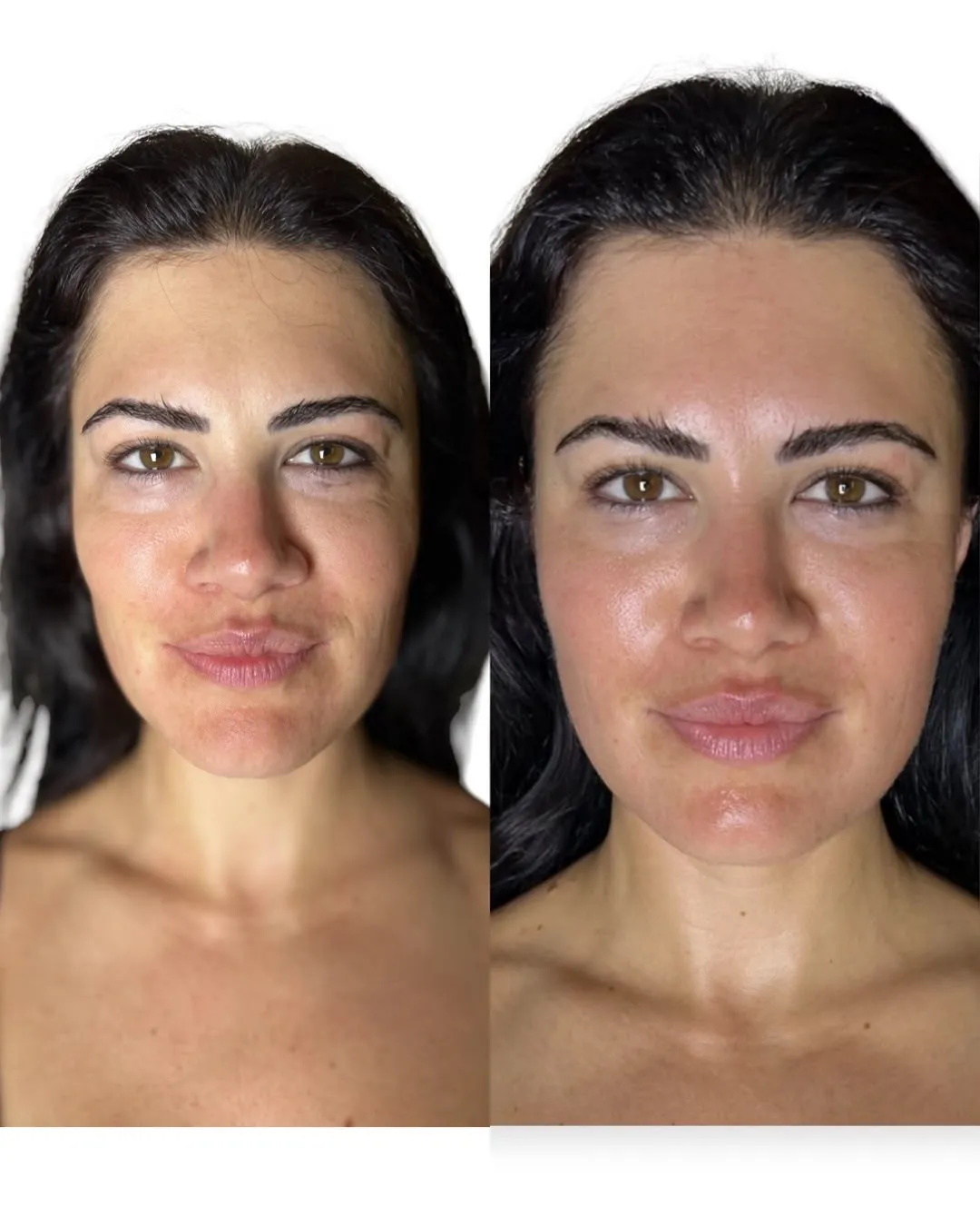 Two photographs of the same face, side by side: before on the left, after on the right