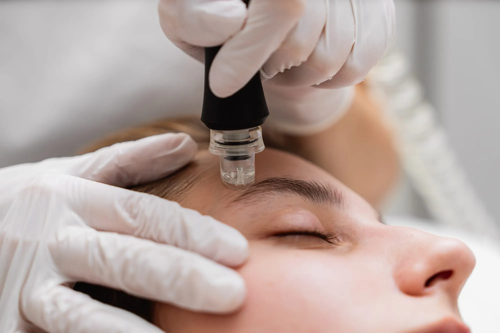 Gloved hands guiding a handpiece over a client’s forehead